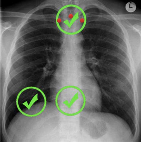 Xray How To Read Flashcards Quizlet