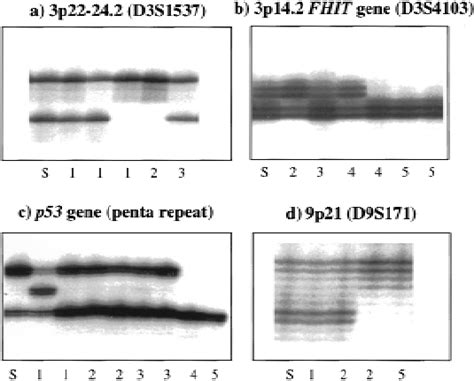 Representative Autoradiographs Of Microsatellite Dna Analyses Involving