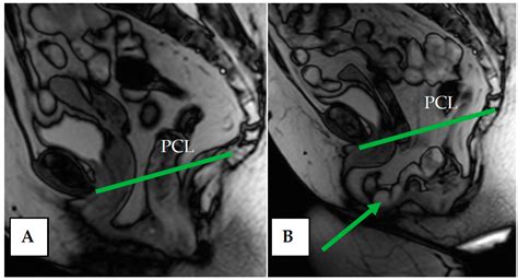 Biomedicines Free Full Text Diagnostic Value Of Dynamic Magnetic