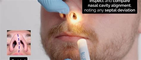 Normal Nasal Passages