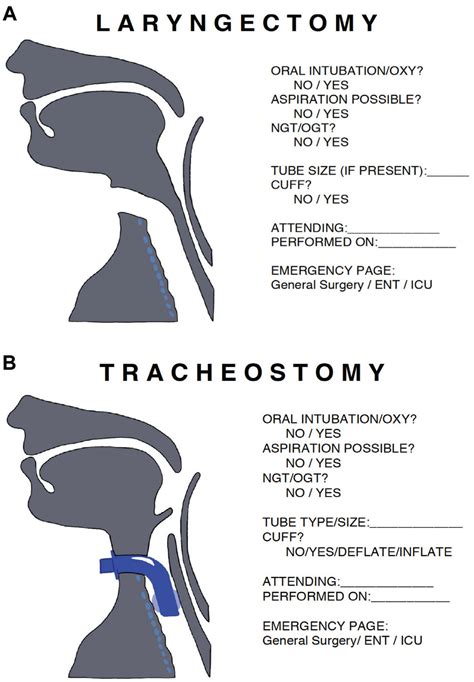 Postoperative Management After Tracheostomy And Laryngectomy Improving Nursing Knowledge With