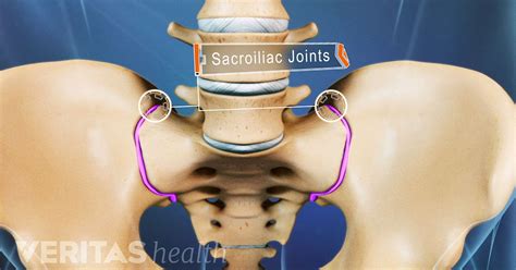 Sacroiliac Joint Dysfunction: Symptoms and Diagnosis