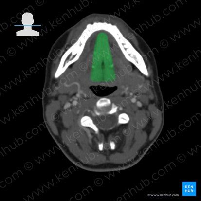 Genioglossus Muscle Attachments And Function Kenhub