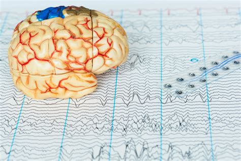 Sensation Du D J Vu Vers Une Explication Scientifique