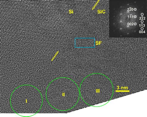 Figure From Restoring Defect Structures In C Sic Si From