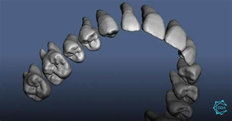 Como Os Sistemas Cad Cam Odontológicos Transformam Sorrisos