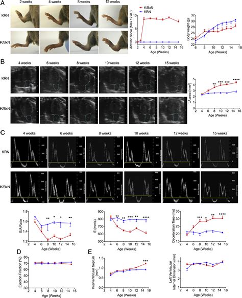 Annexin A Attenuates Cardiac Diastolic Dysfunction In Mice With