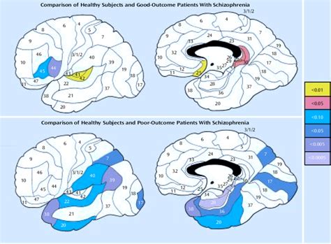 Lateral And Medial Views Of The Brain Showing Brodmanns Areas With