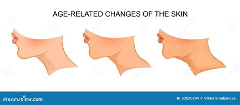 Stages Of Aging Skin