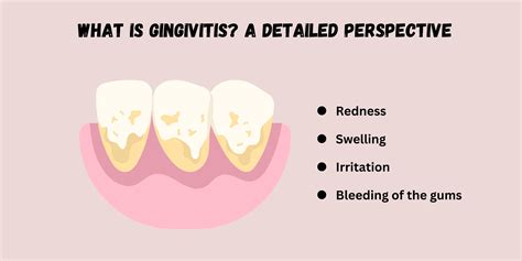 Understanding Gingivitis Gum Disease Symptoms Causes And Treatments