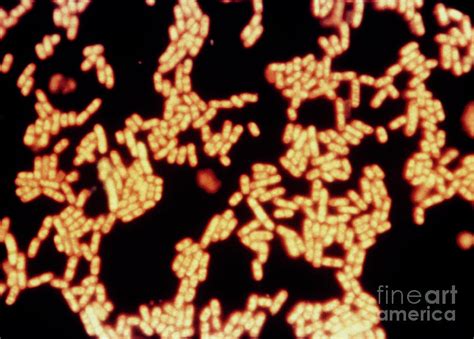 Typhoid Bacteria Salmonella Typhi 1 Photograph By Science Photo