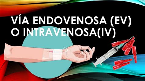 V A Endovenosa O Intravenosa Rebekita Curasi Chuctaya Udocz