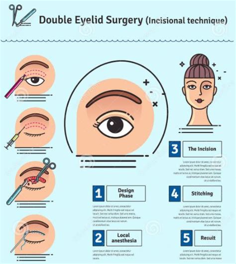 Types Of Plastic Surgery