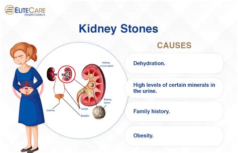 A Comprehensive Guide to Common Urinary Tract Issues | EliteCare