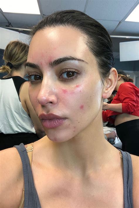 See The Kardashian And Jenner Women S Real Skin Texture After Fans Slam