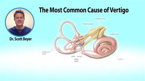 Common Causes of Vertigo: A Comprehensive Guide to Understanding and Managing Dizziness ...