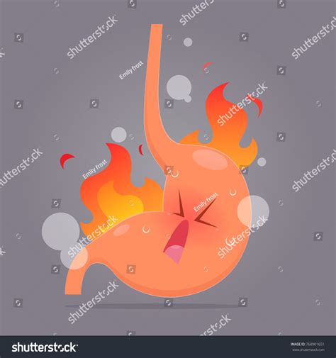 Illustration Acid Reflux Heartburn Cartoon Vector Stock Vector Royalty