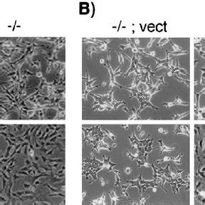 Defective Actin Stress Fiber Response To FTI Treatment A RhoB