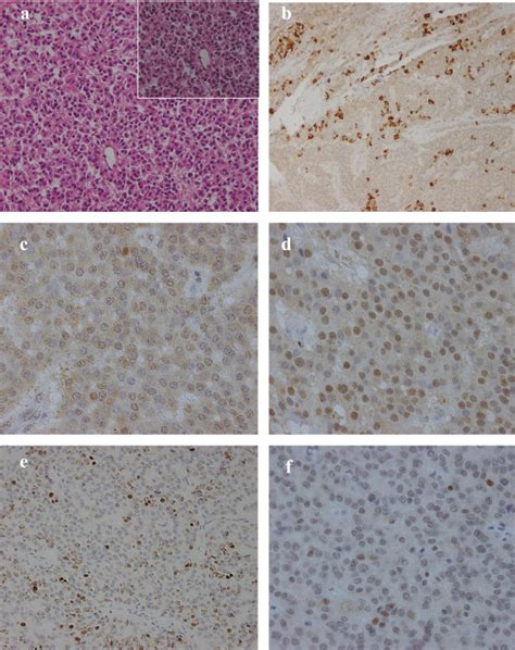 Pathological Findings He Staining And Immunohistochemistry Pictures