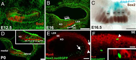 Sox2 Signaling In Prosensory Domain Specification And Subsequent Hair