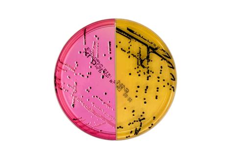 Thermo Scientific Salmonella Shigella Agar Ss Agar Xld Agar Biplate