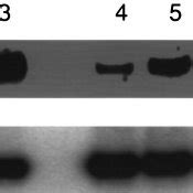 Northern Blot Analysis Of MRNA Expression For IL 8 A And GAPDH B In