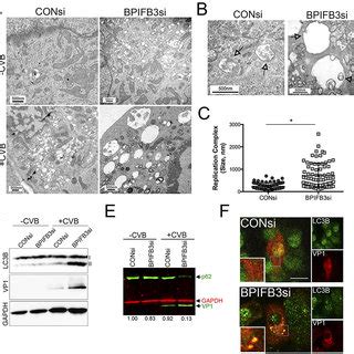 Silencing Of Bpifb Enhances Autophagy During Cvb Infection A