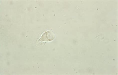 Free Picture Trophozoites Active Form Parasite Body