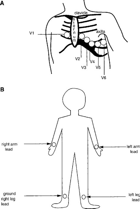 Lead Ekg Limb Diagram Rawanology