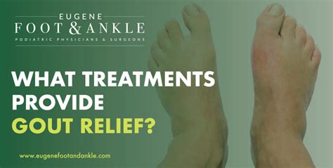 Gout Relief Treatments | Eugene Foot & Ankle