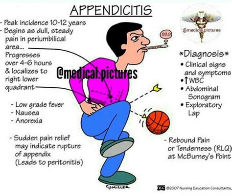 Appendicitis Medical Surgical Nursing Nursing Mnemonics Pediatric