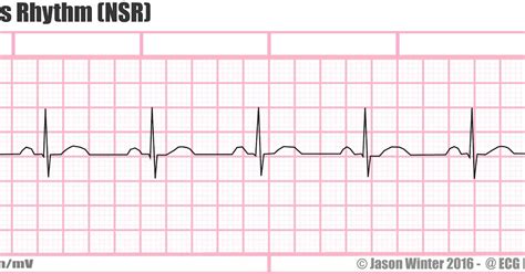 Universal ekg practice strips printable | Harper Blog