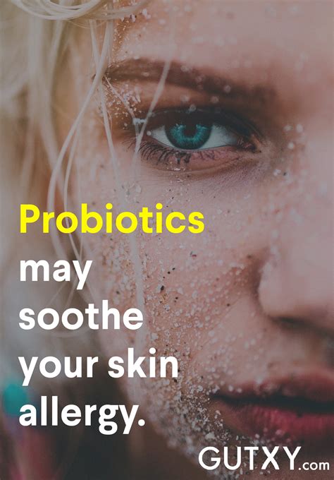 Skin Allergies Whats Gut Bacteria Got To Do With It Gutxy