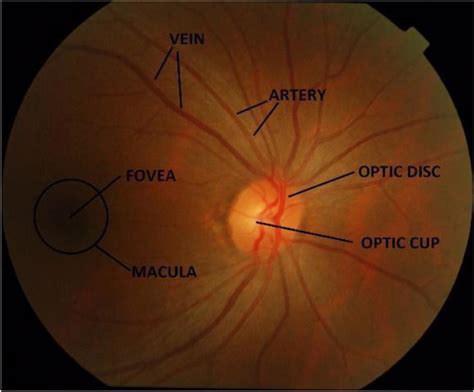 Ocular Fundus Labeled