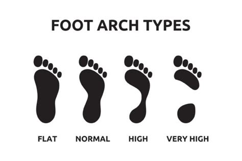 Foot Arch Types Graphic by rasol.designstudio · Creative Fabrica