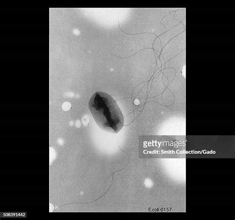 Ecoli O157h7 Photos And Premium High Res Pictures Getty Images