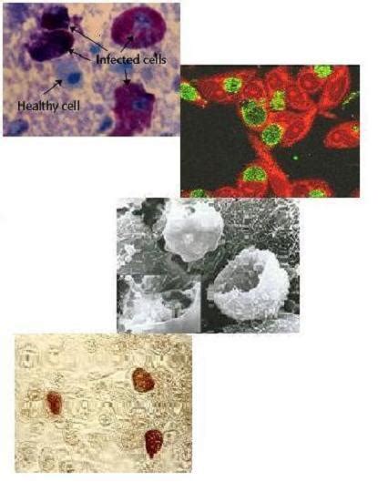 Chlamydia Trachomatis Gram Stain Morphology