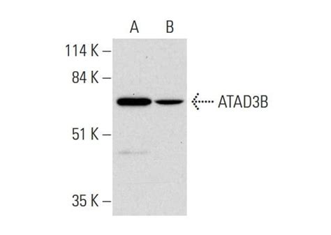 Atad B A Scbt Santa Cruz Biotechnology