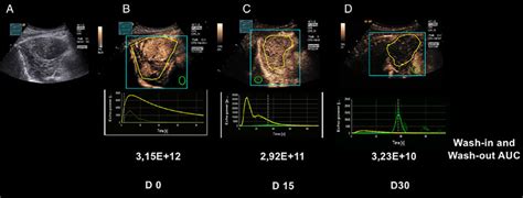 A D Longitudinal B Mode Ultrasound B Us Contrast Enhanced