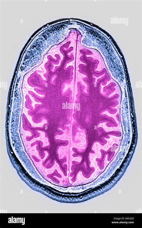 Esame mri immagini e fotografie stock ad alta risoluzione - Alamy