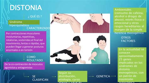 Distrofia Distonia Y Miopatias Musculares PPT Descarga Gratuita