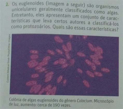 Cromatina Dna Protoctistas Exercícios