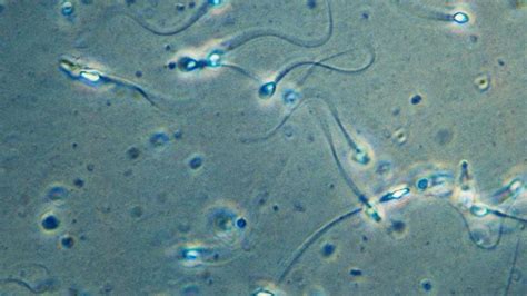 La cola de los espermatozoides se mueve muy rápidamente en 3D no de