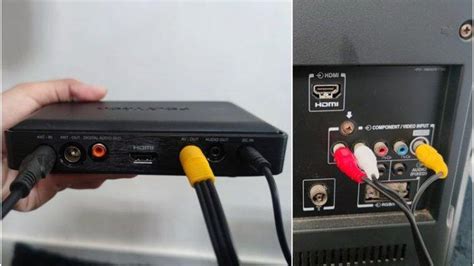 5 Rekomendasi Set Top Box Atau STB Terbaik Lengkap Dengan Harga Dan