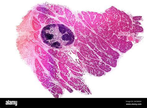 Parotid Salivary Gland Light Micrograph Of A Transverse Section