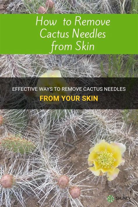 Effective Ways To Remove Cactus Needles From Your Skin Shuncy