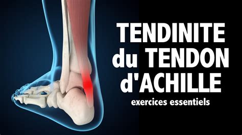 Tendinite Du Tendon D Achille Des Exercices Essentiels Niv