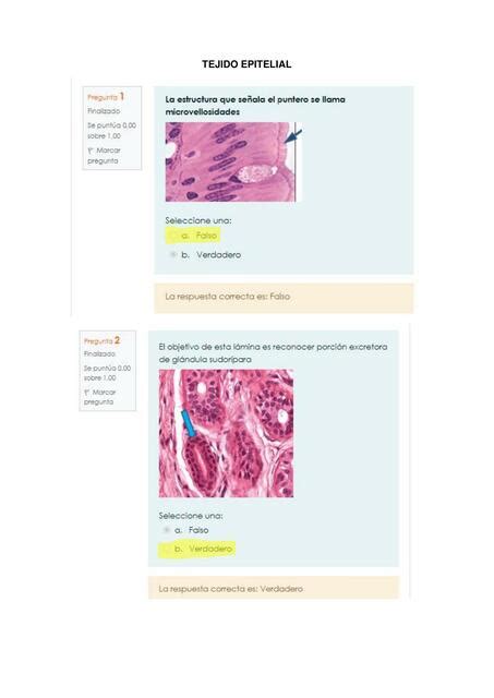 Tejido Epitelial Parcial Paola Vargas UDocz