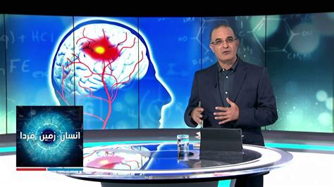 انسان، زمین، فردا پیشگیری و درمان سکته مغزی در گفتگو با دکتر رضا بهروز