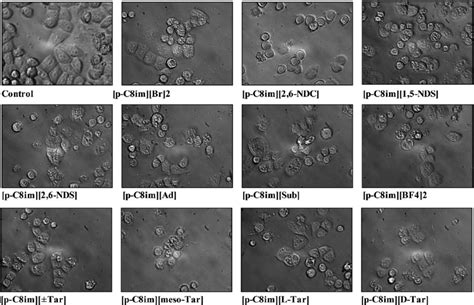 Morphological Observation Under An Inverted Phase Contrast Microscope Download Scientific